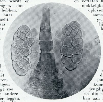 Onbekend, 1933, Onbekend, EIZAKKEN VAN HJVT WIJFJE VAN DEN ZOETWATEREENOOG (CYCLOPS. VULGARIS) (625 x VERGROOT)