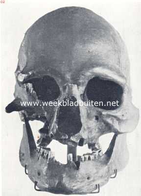 De schedel van Oberkassel, afkomstig van een Cromagnonmensch. Men lette op de recente trekken en de kin